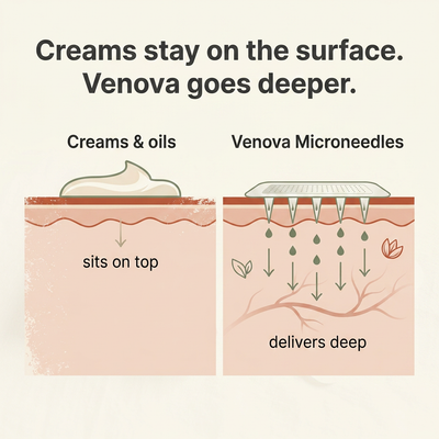 Venova® — Show Your Legs Again