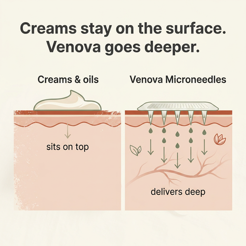 Venova® — Show Your Legs Again